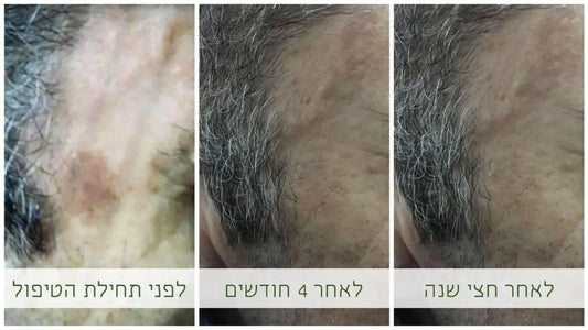 הבהרה בטוחה ויעילה